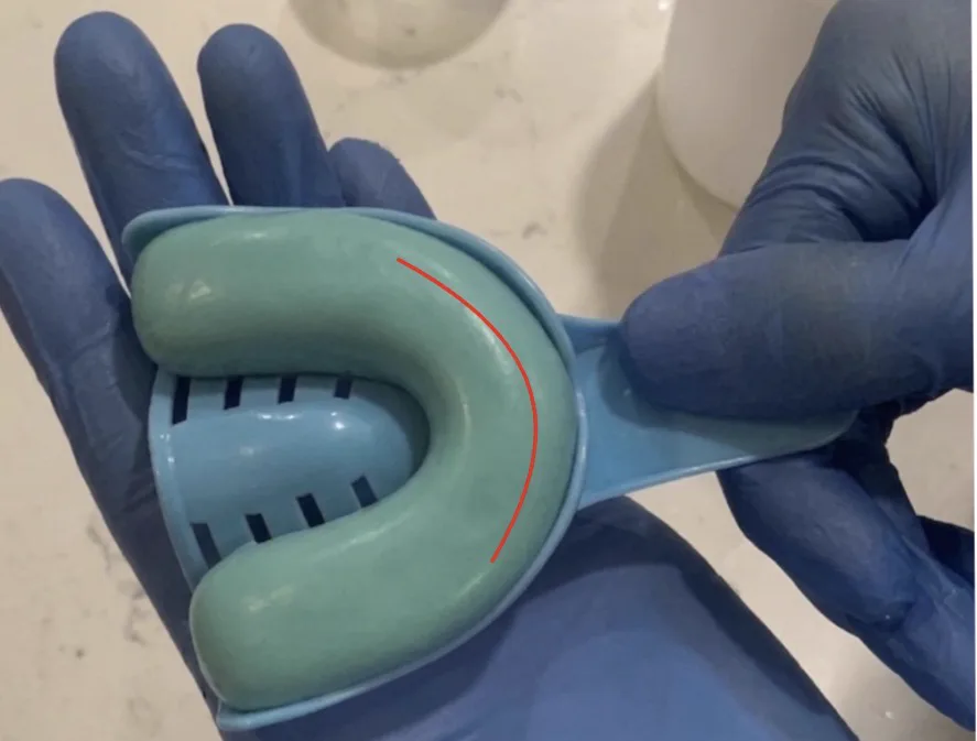 Properly loaded putty tray reference