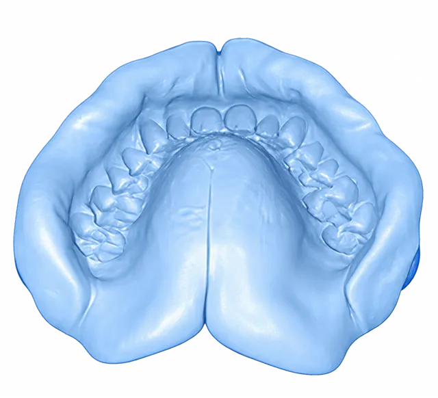 A good impression seen from above: front teeth, molars and palate all clear with no smears or tears